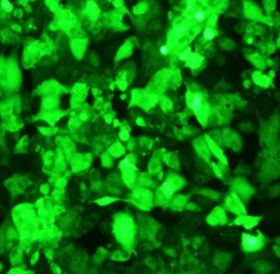 GFP Expressing Human Renal Adenocarcinoma Cells (ACHN)