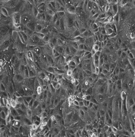 GFP Expressing Human Renal Adenocarcinoma Cells (ACHN)