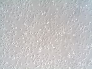 RFP Expressing LN18 grown using Universal Full Growth Medium (cat. TM001)