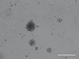 VcaP cells in culture.